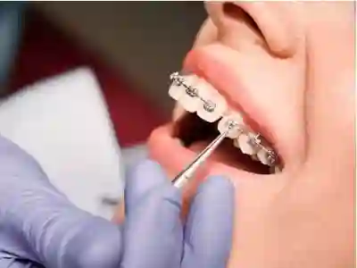 Orthodontist